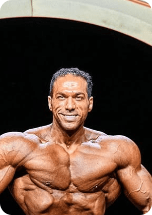 قبل وبعد زراعة الشعر في تركيا