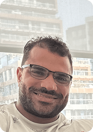 قبل وبعد زراعة الشعر في تركيا