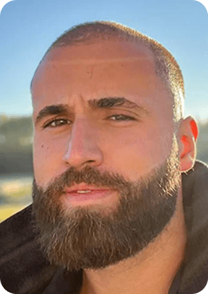 قبل وبعد زراعة اللحية في تركيا