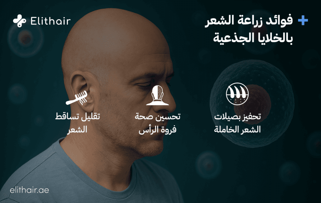 فوائد الخلايا الجذعية - مركز اليت هير لزراعة الشعر